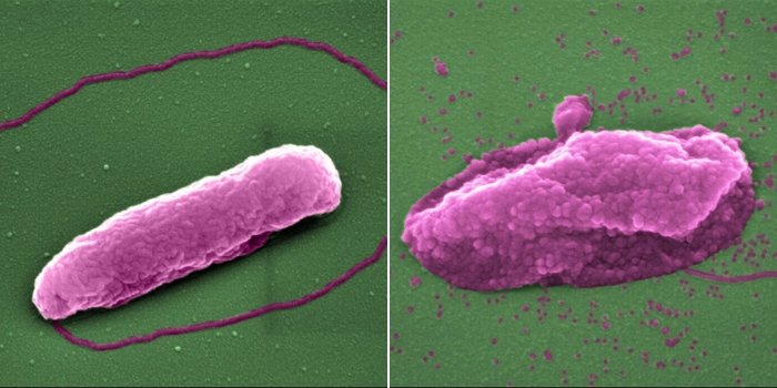 Супербактерія Pseudomonas aeruginosa до (зліва) та після (справа) впливу колістину.&amp;nbsp;Imperial College London
