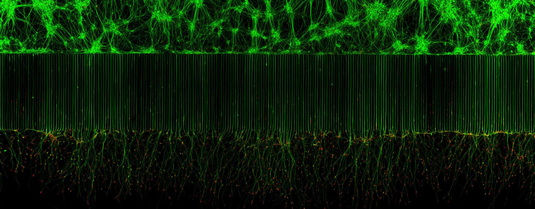 Моторні нейрони, вирощені у мікрофлюїдному пристрої. Melinda Beccari &amp;amp; Dr. Don W. Cleveland