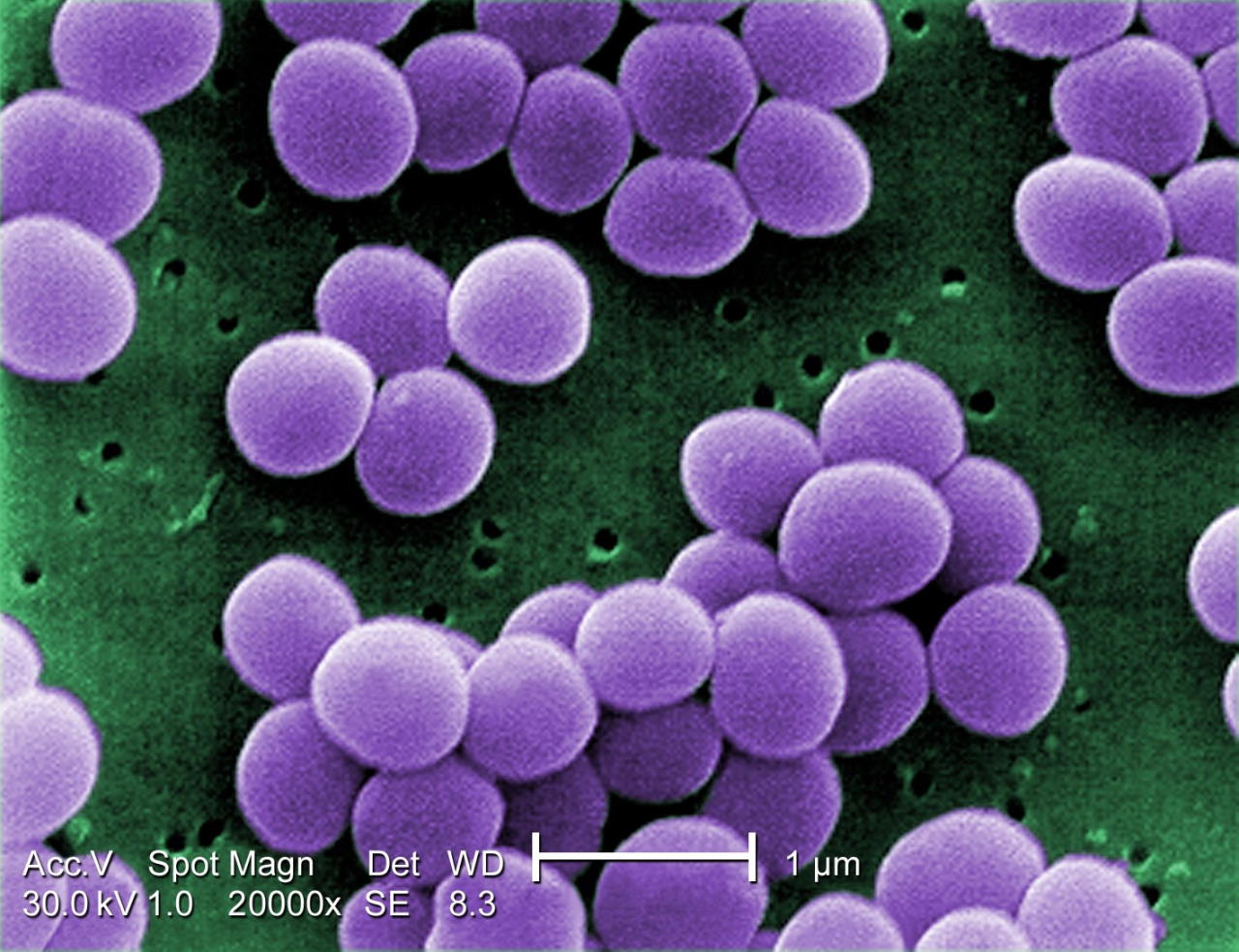 Бактерії золотистого стафілокока (Staphylococcus aureus) під мікроскопом — поширеного збудника внутрішньолікарняних інфекцій. Janice Haney Carr