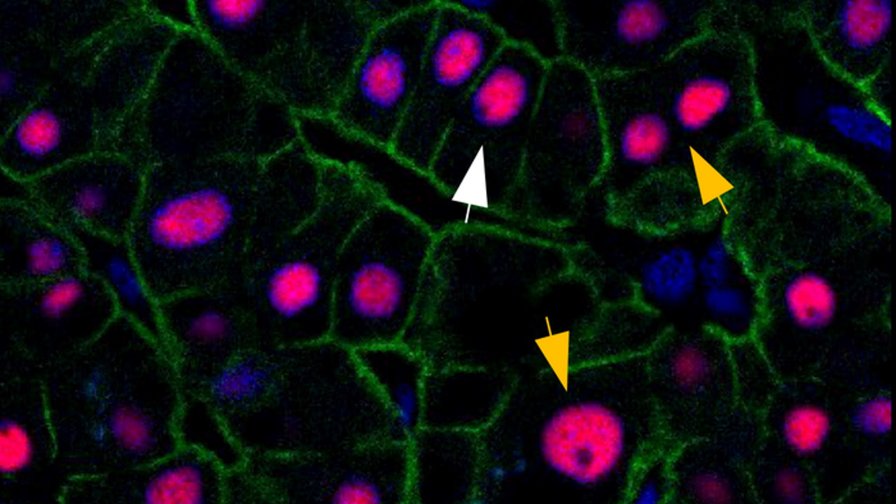 Білі стрілки вказують на гепатоцити з двома копіями ДНК, жовті - з більшою кількістю копій.&amp;nbsp;Paula Heinke /&amp;nbsp;Cell Systems, 2022