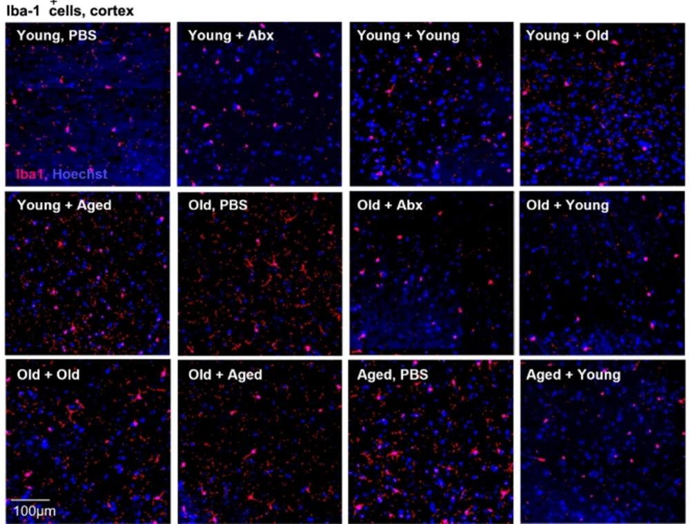 Кількість активованих клітин мікроглії (червоні) у корі молодих, старших та старих мишей, які отримали лише сольовий розчин (PBS), лише антибіотики (Abx) або фекальні транспланти від молодих, старших або старих мишей.&amp;nbsp;Aimée Parker et al. /&amp;nbsp;Microbiome, 2022