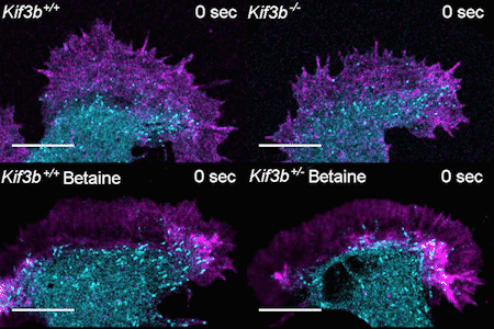 Верхній лівий кут: здорові нейрони. Верхній правий кут: нейрони з мутацією гену&amp;nbsp;Kif3b. Нижній лівий кут: здорові нейрони миші, що вживала бетаїн як добавку, не змінили нормальної структури. Нижній правий кут: відновлена структура нейронів миші з мутацією Kif3b, що вживала бетаїн як добавку. Синім кольором позначено мікротрубочки клітинного скелету, а рожевим&amp;nbsp;— актинові нитки.&amp;nbsp;N. Hirokawa et al. / Cell Reports, 2021