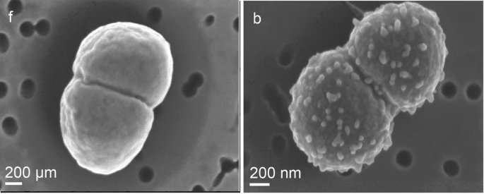 Зображення бактерії з контрольної групи (зліва) та експериментальної (справа). Ott et al. / Microbiome, 2020