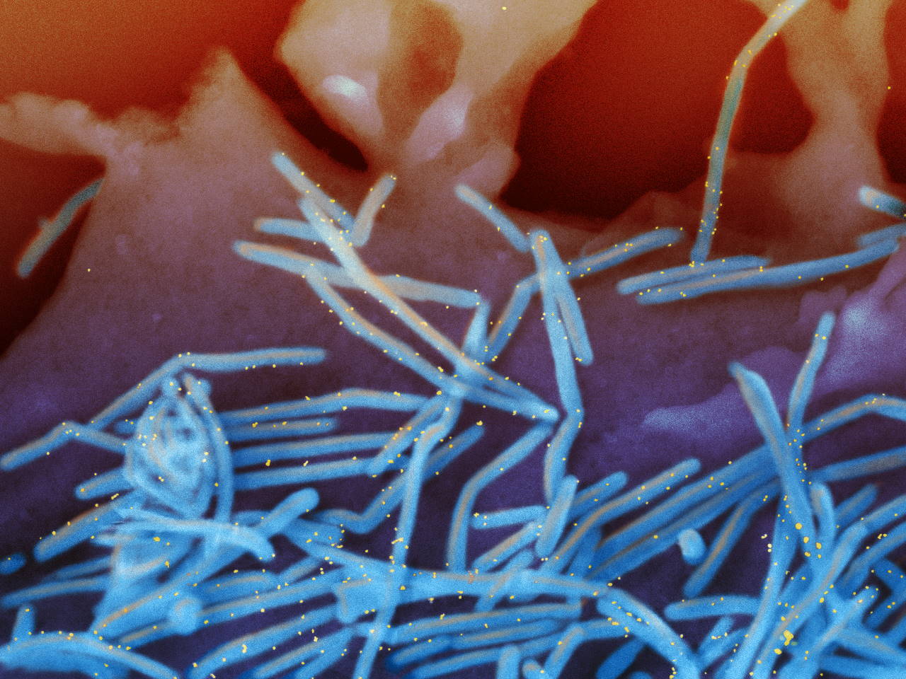 Респіраторно-синцитіальний вірус (сині) з поміченим F-білком (жовті).&amp;nbsp;NIAID