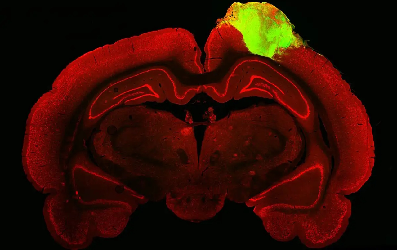 Людський мозковий органоїд (зелений), трансплантований у мозок пацюка.&amp;nbsp;Jgamadze et al. / Cell Stem Cell, 2023
