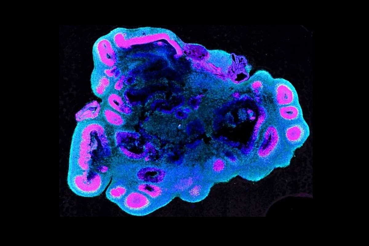 П'ятитижневий органоїд мозку людини. S.Benito-Kwiecinski / MRC LMB / Cell