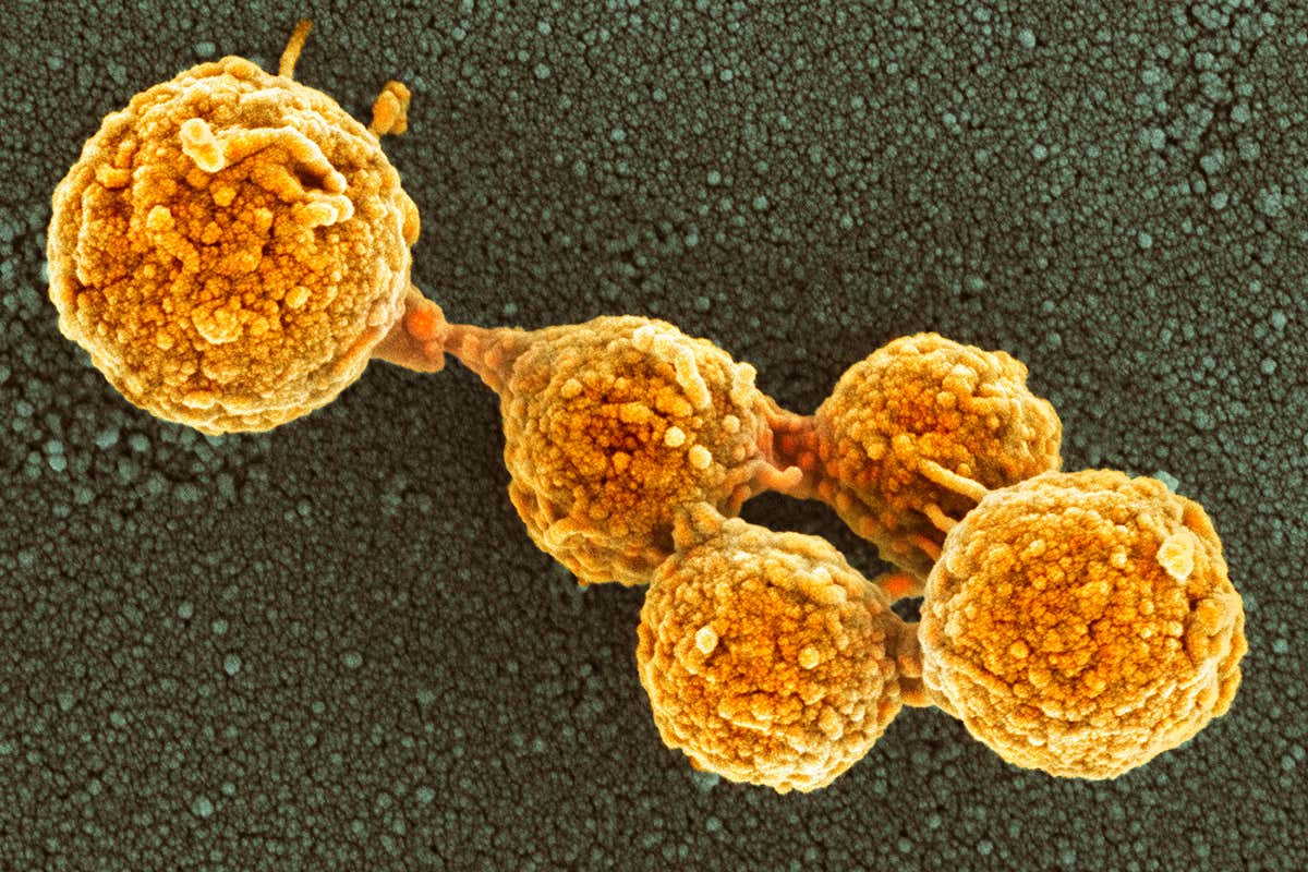 Одна з перших синтетичних бактерій. THOMAS DEERINCK, NCMIR / SCIENCE PHOTO LIBRARY