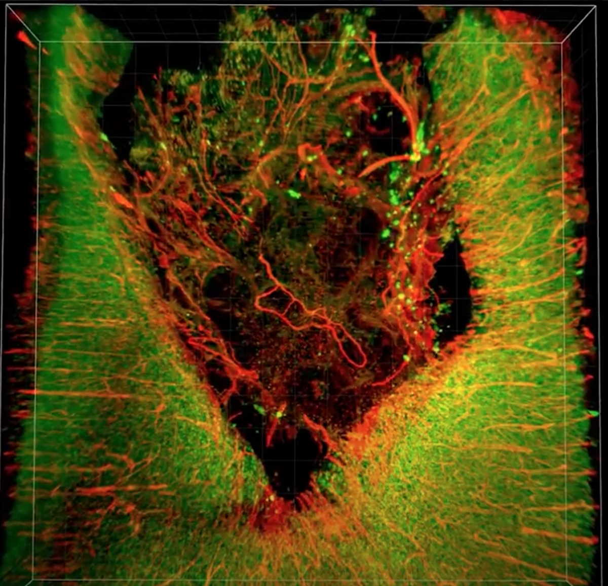 3D-зображення пошкодженої ділянки мозку пацюка (в центрі), обробленого «мозковим клеєм». Активні нейрони (зелені) та кровоносні судини (червоні лінії) свідчать про процес загоювання. Charles-Francois V. Latchoumane et al. / Science Advances, 2021