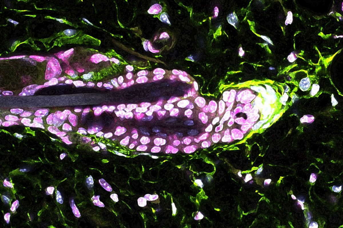Клітини дермального сосочка (зелені) виробляють білок GAS6, який активує стовбурові клітини волосяного фолікула. Hsu Laboratory / Harvard University
