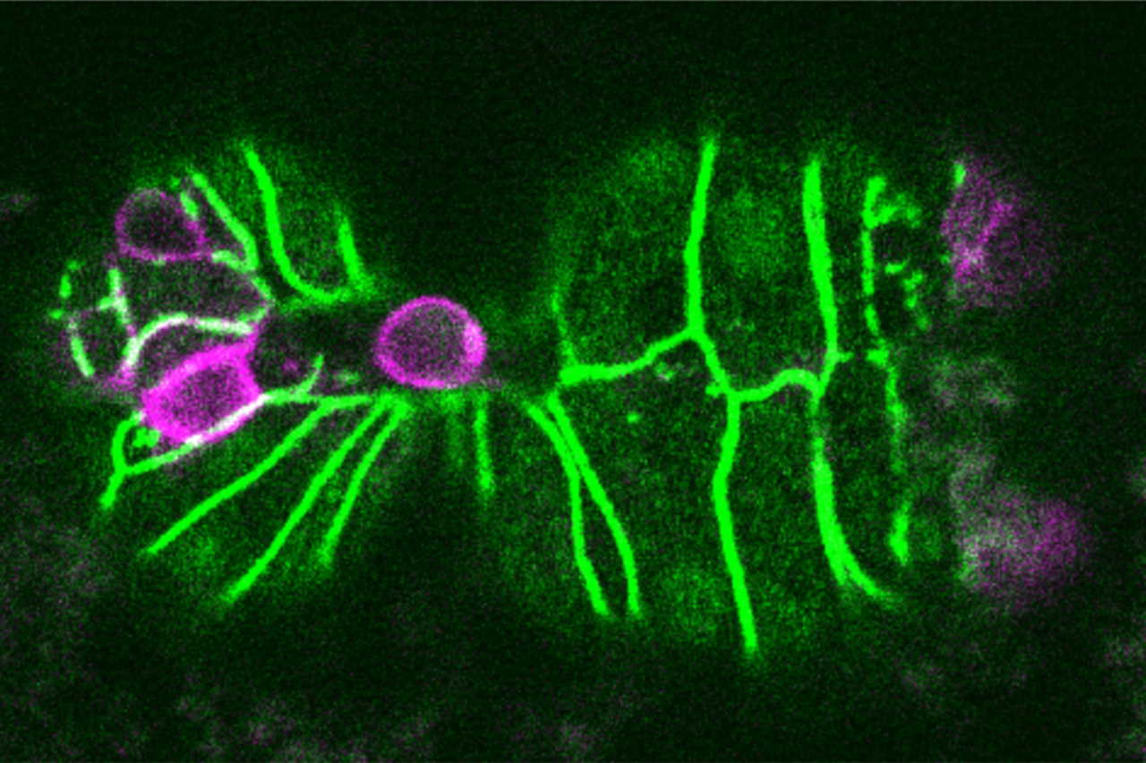 Ембріон C. elegans (зелений) витісняє клітину (рожева в центрі зображення) під час ембріонального розвитку. MIT