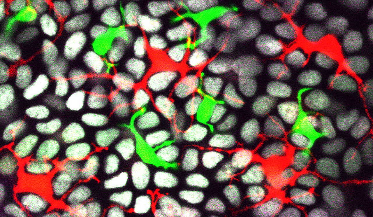 Епітеліальні клітини (сірі), клітини Лангерганса (червоні) та дендритні епідермальні Т-клітини (зелені). Greco Lab