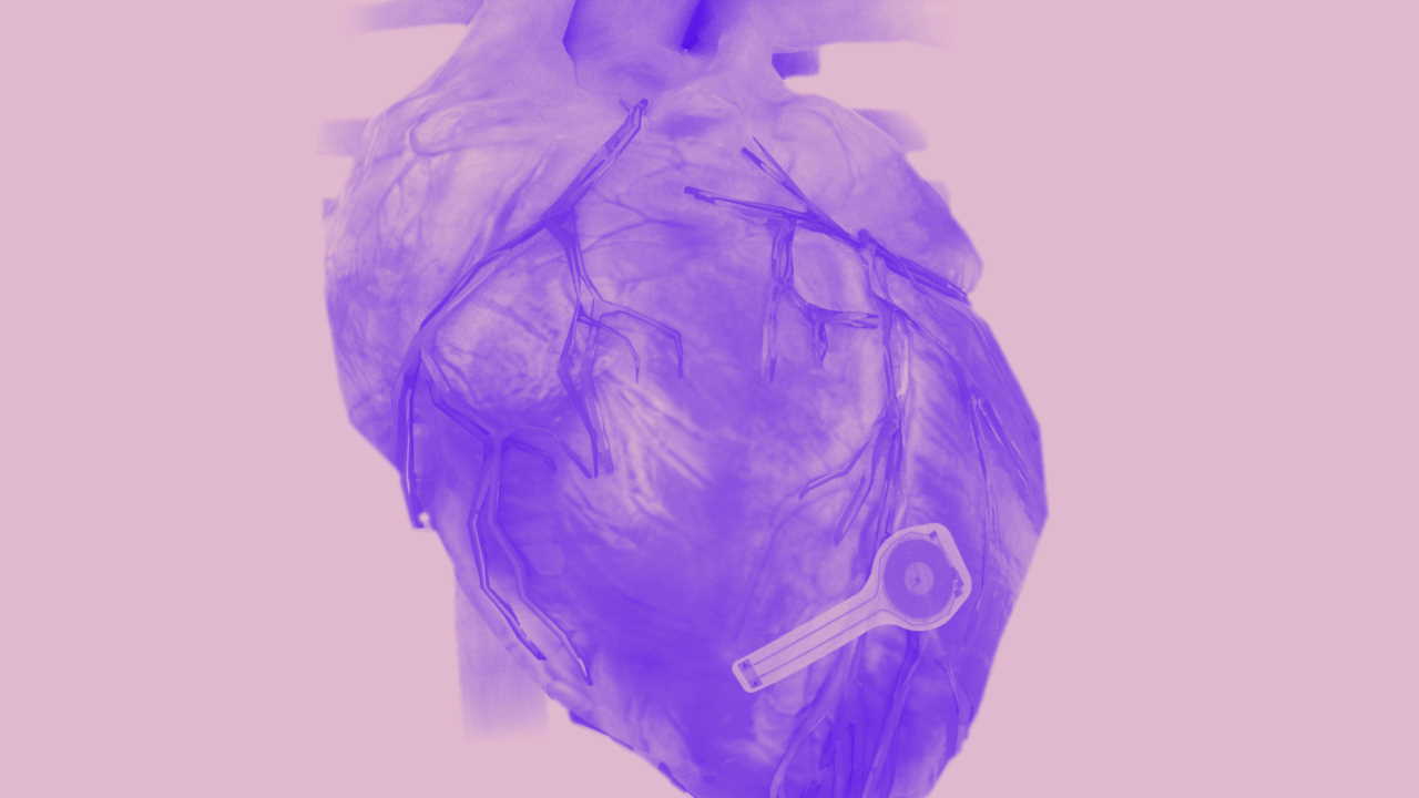 Художнє зображення біорозкладного кардіостимулятора на поверхні серця.&amp;nbsp;Northwestern University