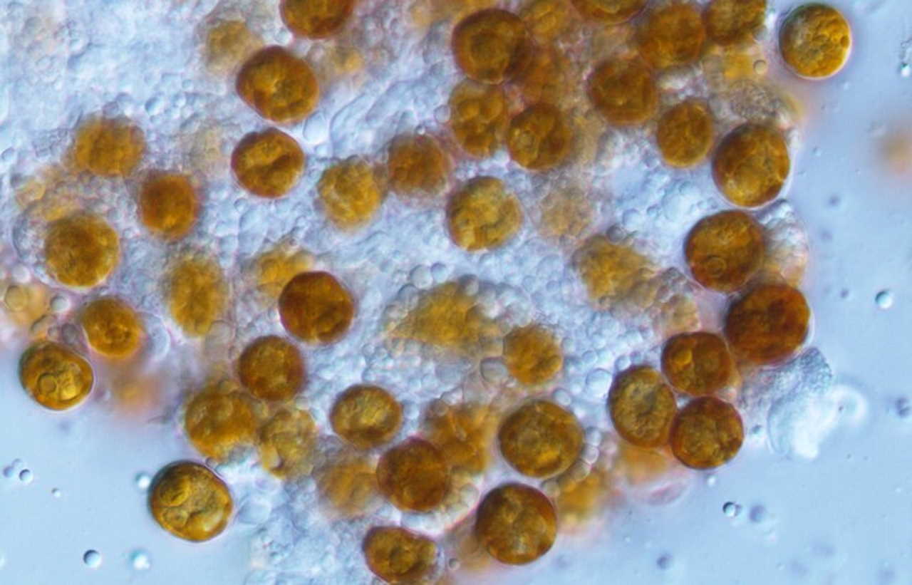 «Жовті клітини» симбіотичних водоростей Philozoon collosum, добуті з коралів Capnella gaboensis. Matthew R. Nitschke