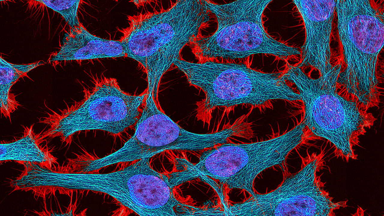 Клітини раку шийки матки лінії HeLa. National Institutes of Health / Wikimedia Commons