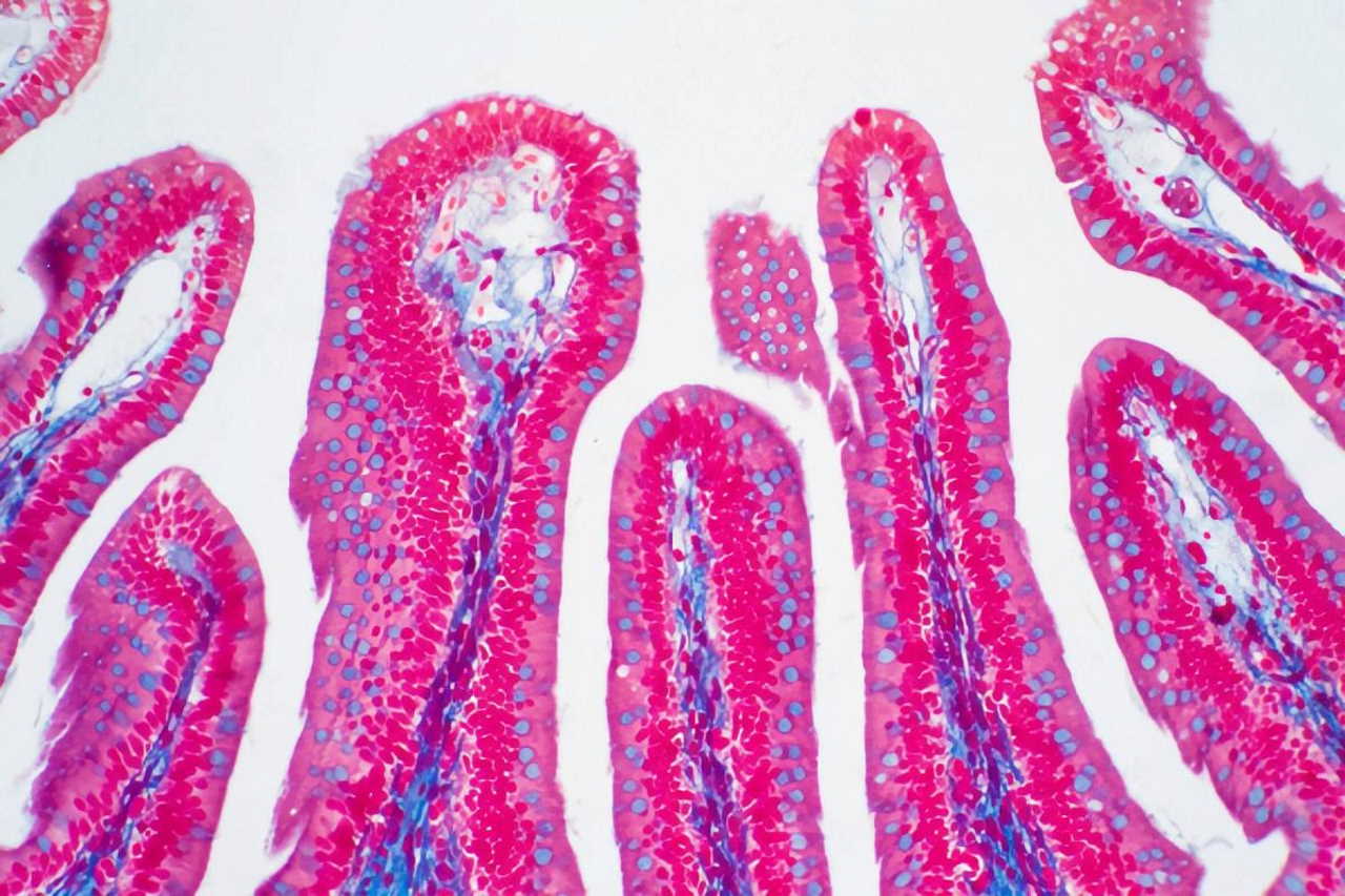 Мікроскопічне зображення товстої кишки людини / Depositphotos