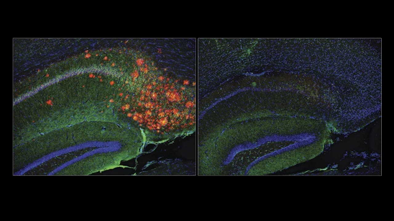 Кількість амілоїдних бляшок та клубків тау-білків (червоно-помаранчеві скупчення) у мозку візуально зникає після блокування вироблення холестерину астроцитами (справа). Scott Hansen lab / Scripps Research