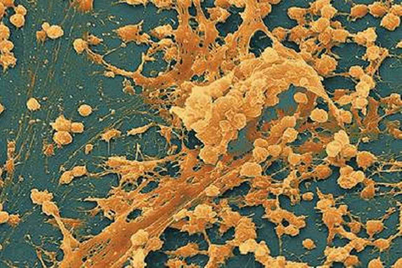 Бактеріальна біоплівка під мікроскопом. National Institutes of Health