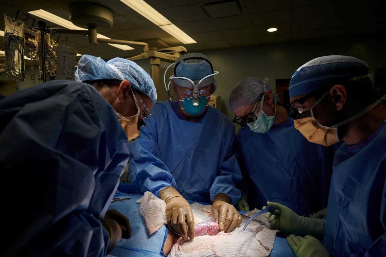 Трансплантація нирки свині людині. Joe Carrotta for NYU Langone Health/Handout via REUTERS