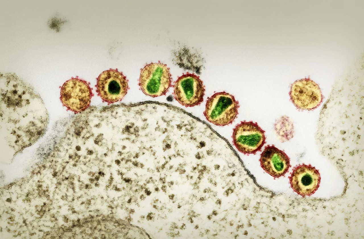 Віруси імунодефіциту людини на зображенні з електронного мікроскопа. R. Gelderblom / RKI / dpa