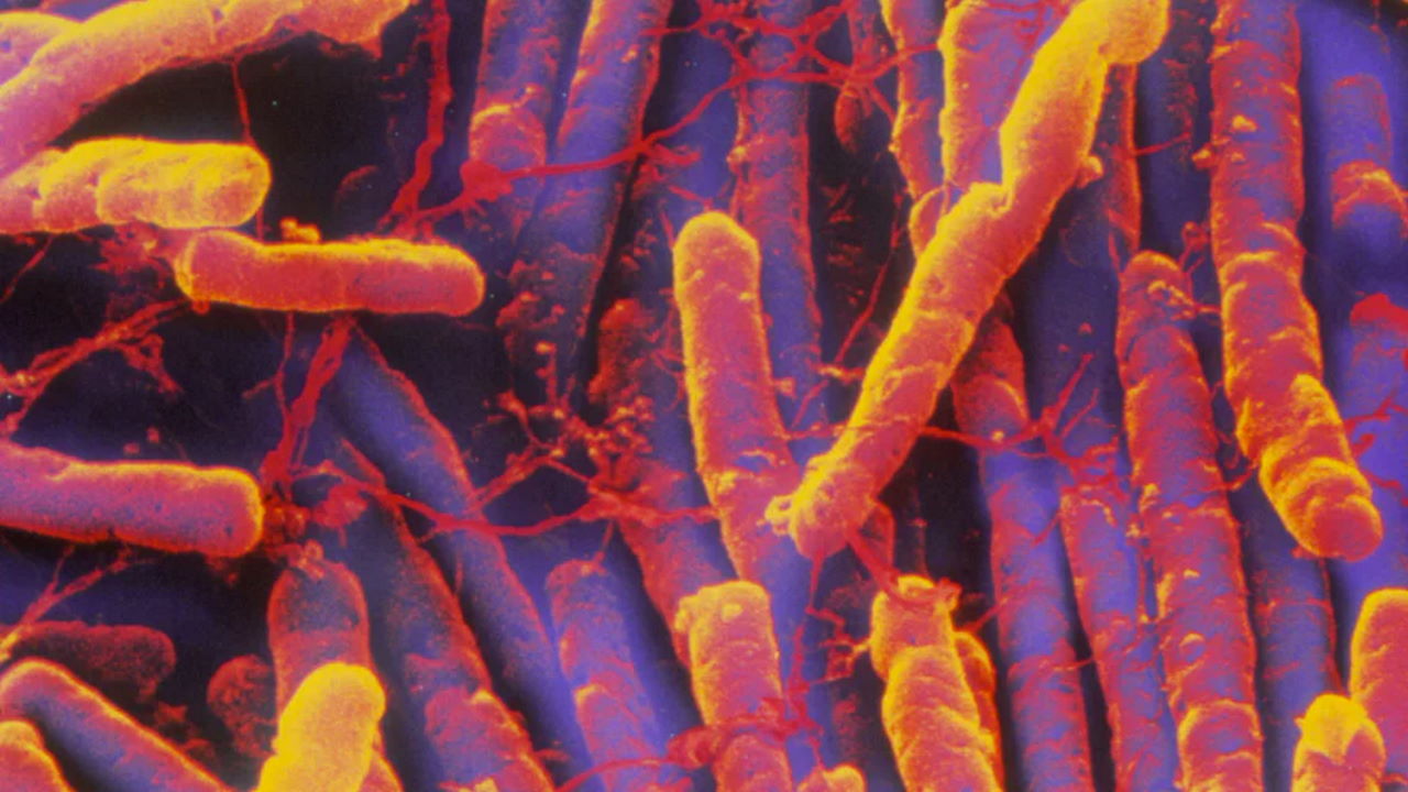Бактерії C. difficile. Phillips D. / Science Photo Library