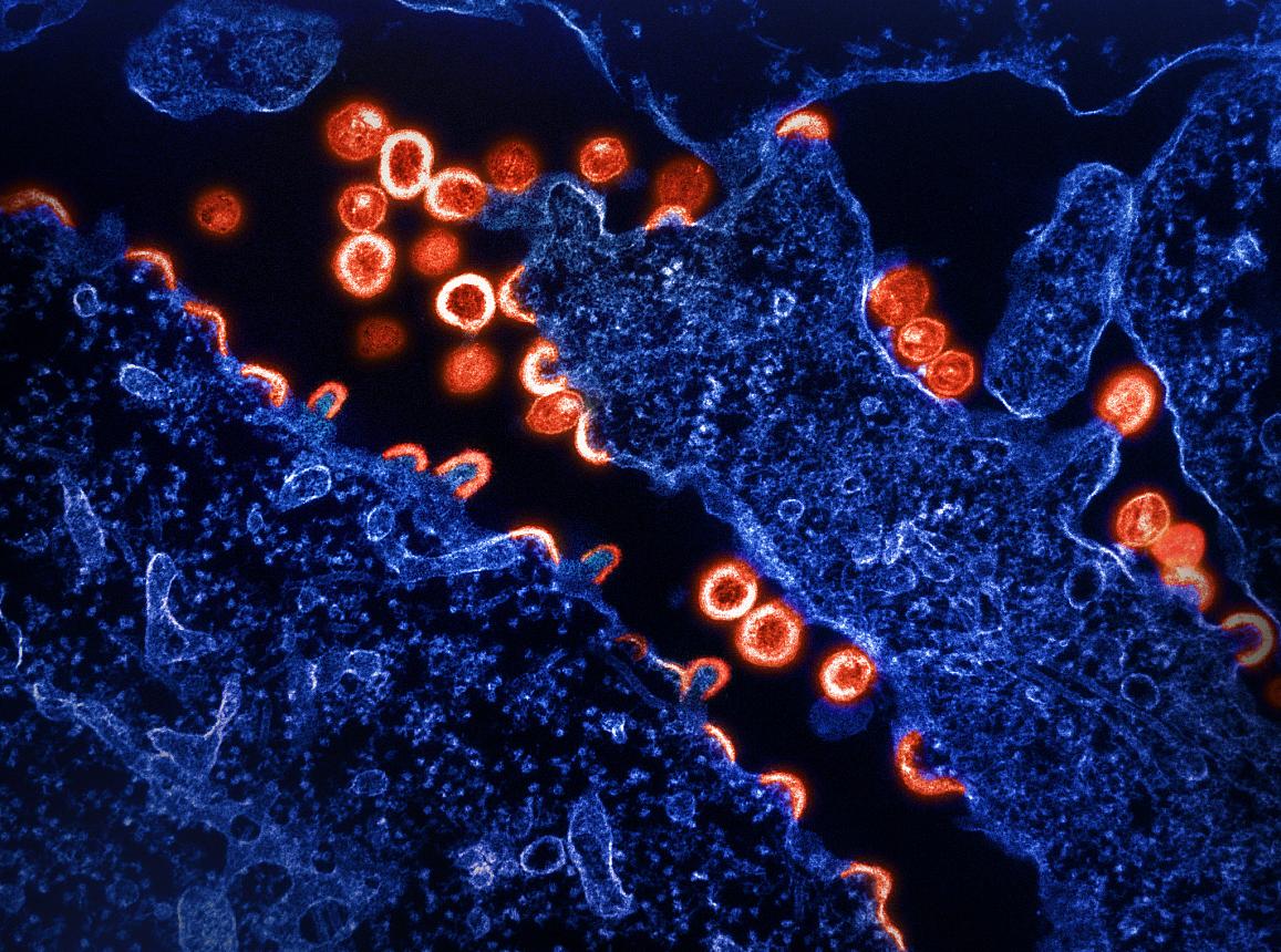 Вихід частинок ВІЛ-1 (червоні) з інфікованої клітини. NIAID