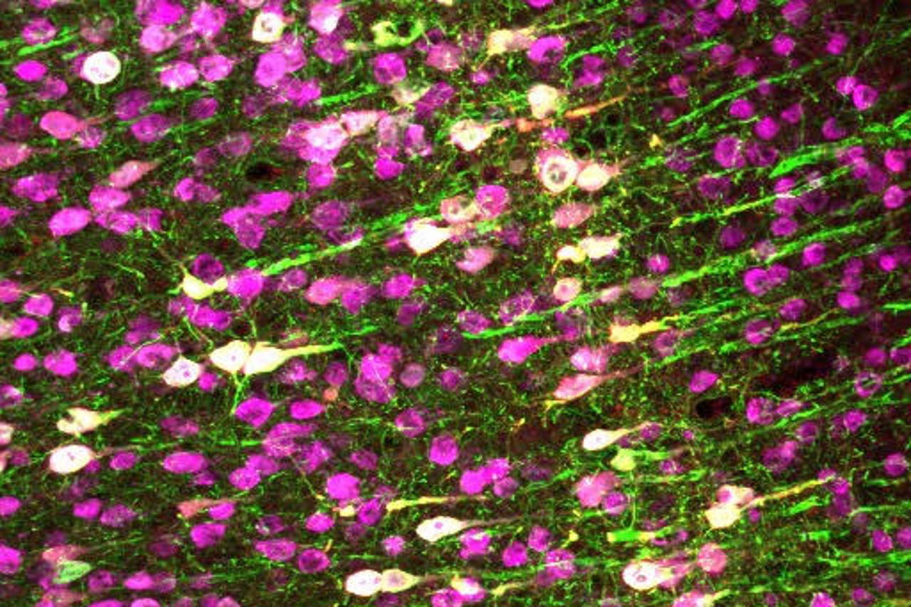 Експресія&amp;nbsp;TRPA1 (білий) та зеленого флуоресцентного білка (зелений) нейронами мишей (рожеві).&amp;nbsp;Salk Institute