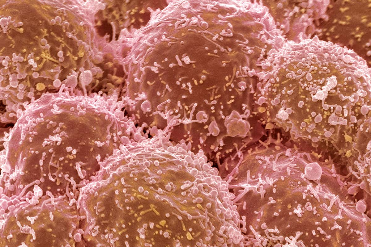 Клітини раку легень. Science Photo Library / Alamy