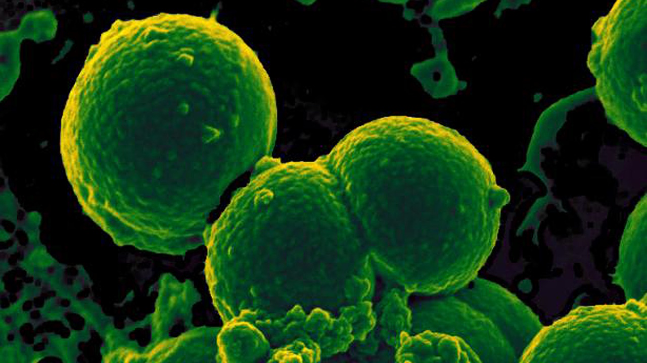 Стійка до антибіотика метициліну бактерія Staphylococcus aureus. NIAID