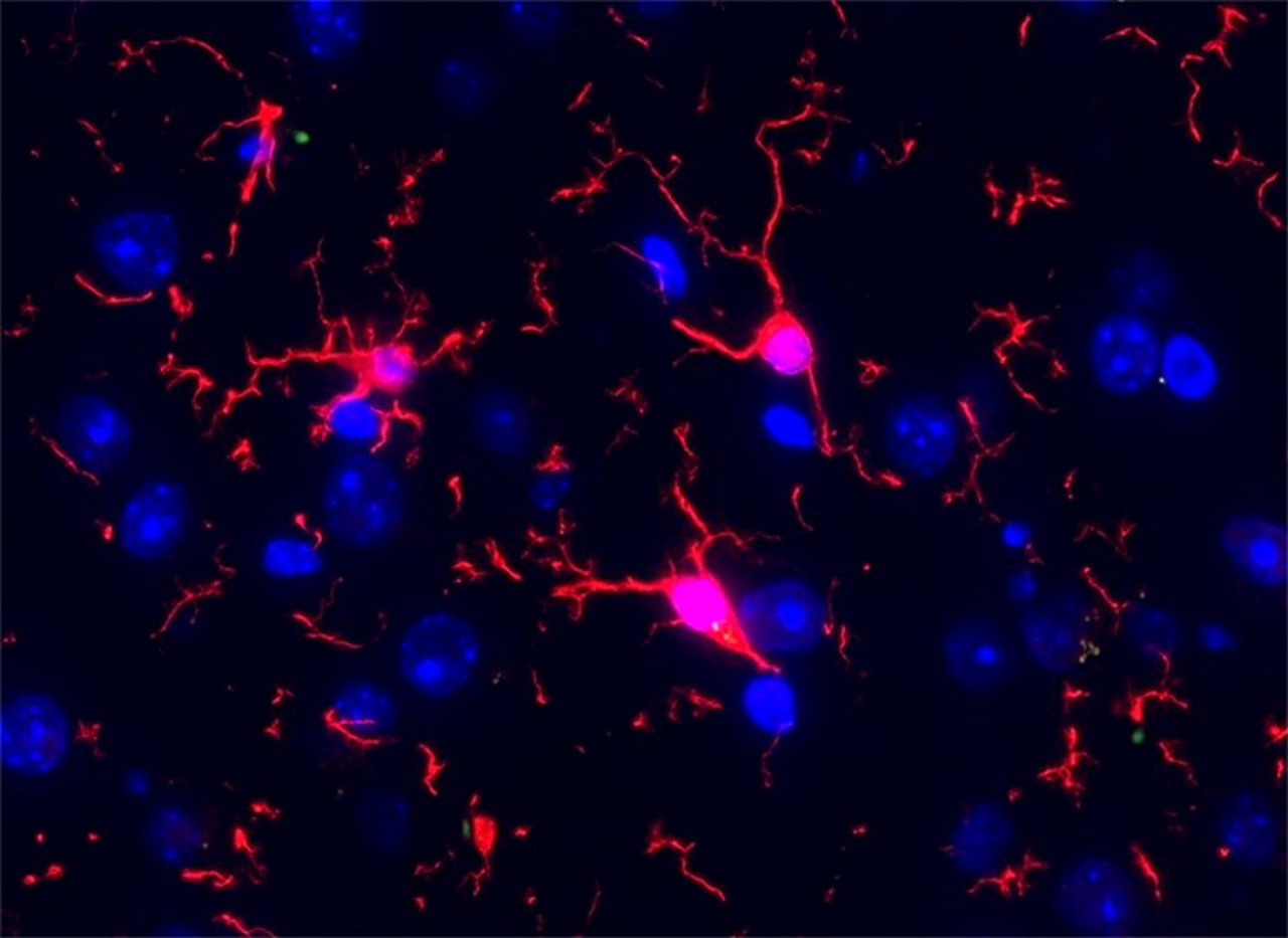 Запальні клітини (червоні) у мозку старої миші.&amp;nbsp;Quadram Institute