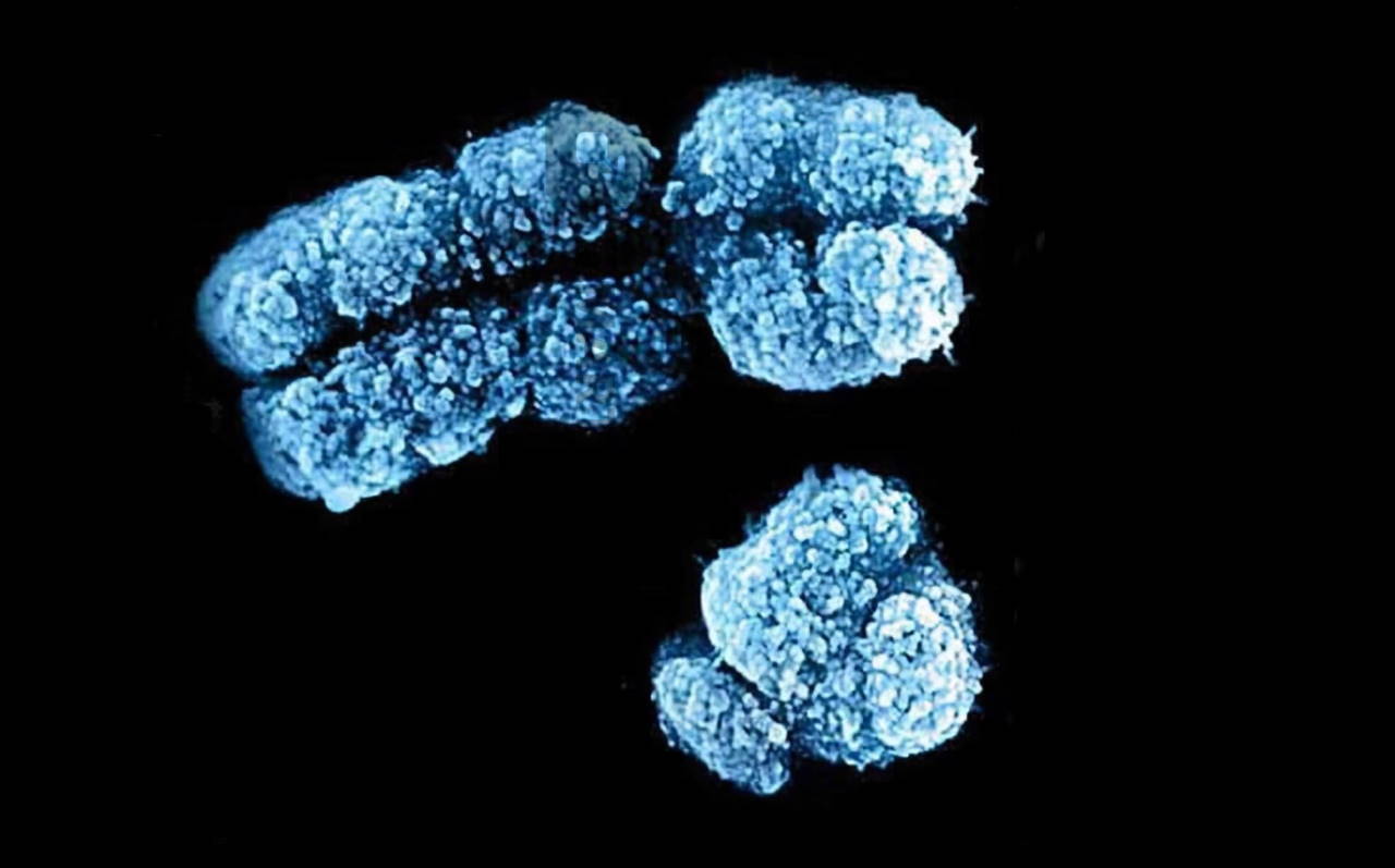 Хромосоми Х (зверху) та&amp;nbsp;Y (знизу) на зображенні сканувального електронного мікроскопа.&amp;nbsp;UC San Diego