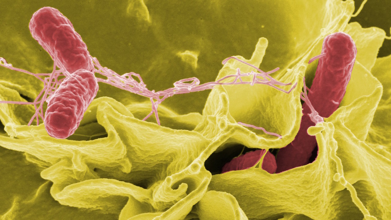 Бактерія Salmonella typhimurium, яку використали для доставки вірусу в пухлини, під сканувальним електронним мікроскопом. Rocky Mountain Laboratories, NIAID, NIH