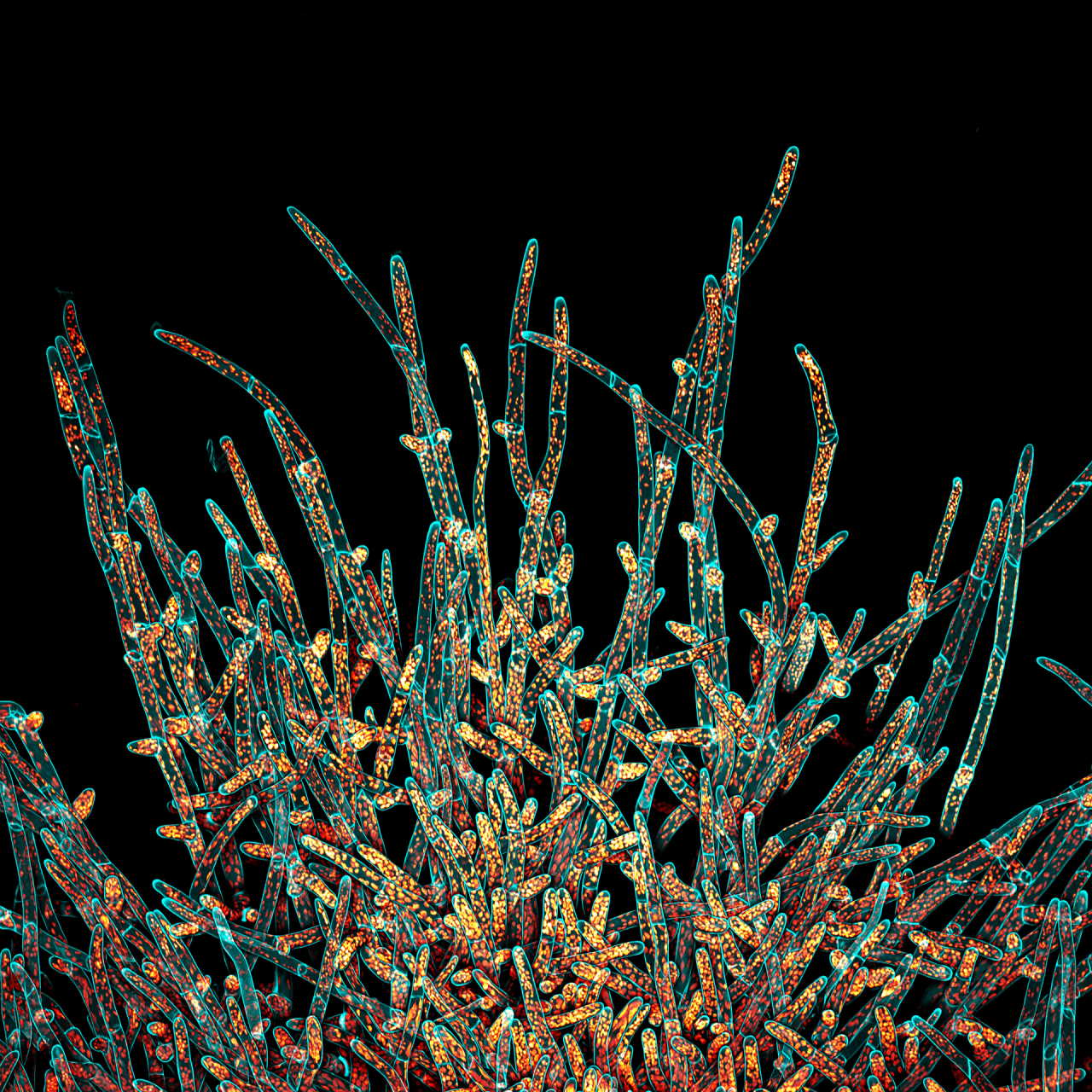 Зображення клітин протонеми моху Physcomitrium patens. Клітинні стінки (сині) забарвлені калькофлуор білим, автофлуоресценція хлоропластів помітна жовтим. Ivan Radin