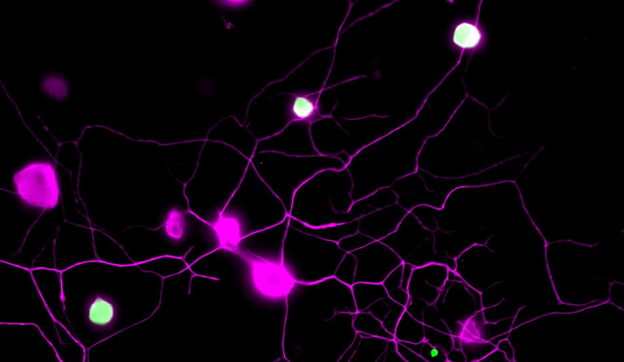 Сенсорні нейрони мишей (рожеві), частина з яких виробляє ВН4 (зелено-білі).&amp;nbsp;Cronin / IMBA