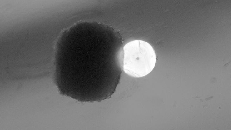 Біле коло — поперечний розріз скляного капіляра, діаметр якого становить трохи більше ніж 200 нанометрів. Чорна точка посередині — канал, по якому транспортується препарат. Зліва від скляної трубки —&amp;nbsp; сфера з клітин гліобластоми. The Medical University of Graz