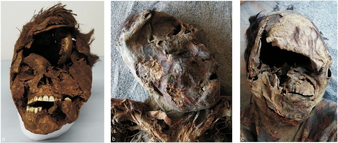 Смертельні травми черепа, що призвели до спотворення обличчя. Standen et al. / Journal of Anthropological Archaeology, 2021