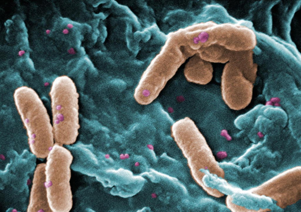 Ця симпатична штука  —  синьогнійна паличка Pseudomonas aeruginosa. Вона також одна з шести бактерій, які разом несуть відповідальність за 929 000 смертей у 2019 році. Janice Haney Carr / Wikimedia Commons 