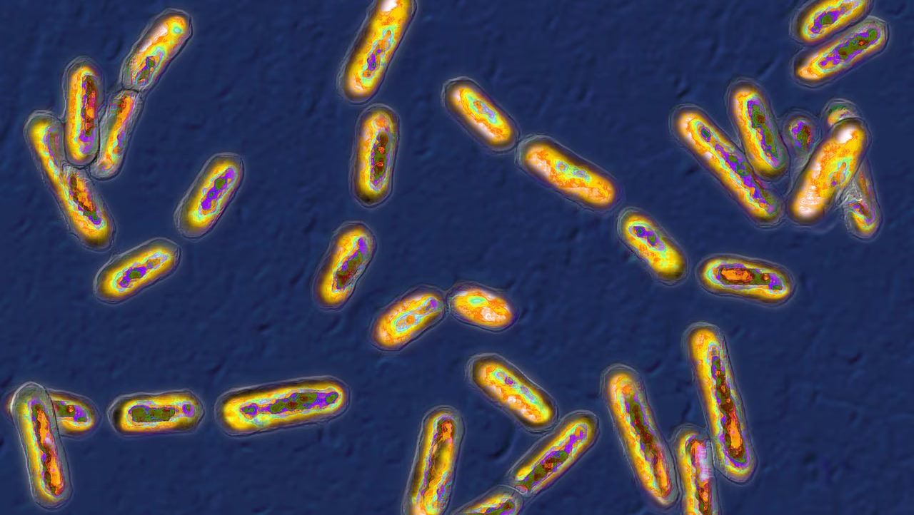 Clostridium difficile під мікроскопом. BSIP / Universal Images Group / Getty Images