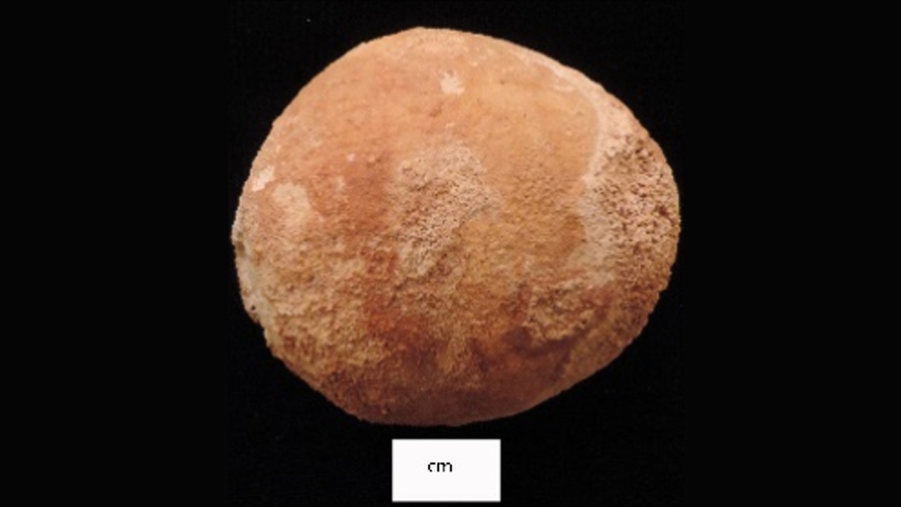 Камінь із сечового міхура давньоєгипетської жінки. Gretchen R. Dabbs / International Journal of Paleopathology, 2023