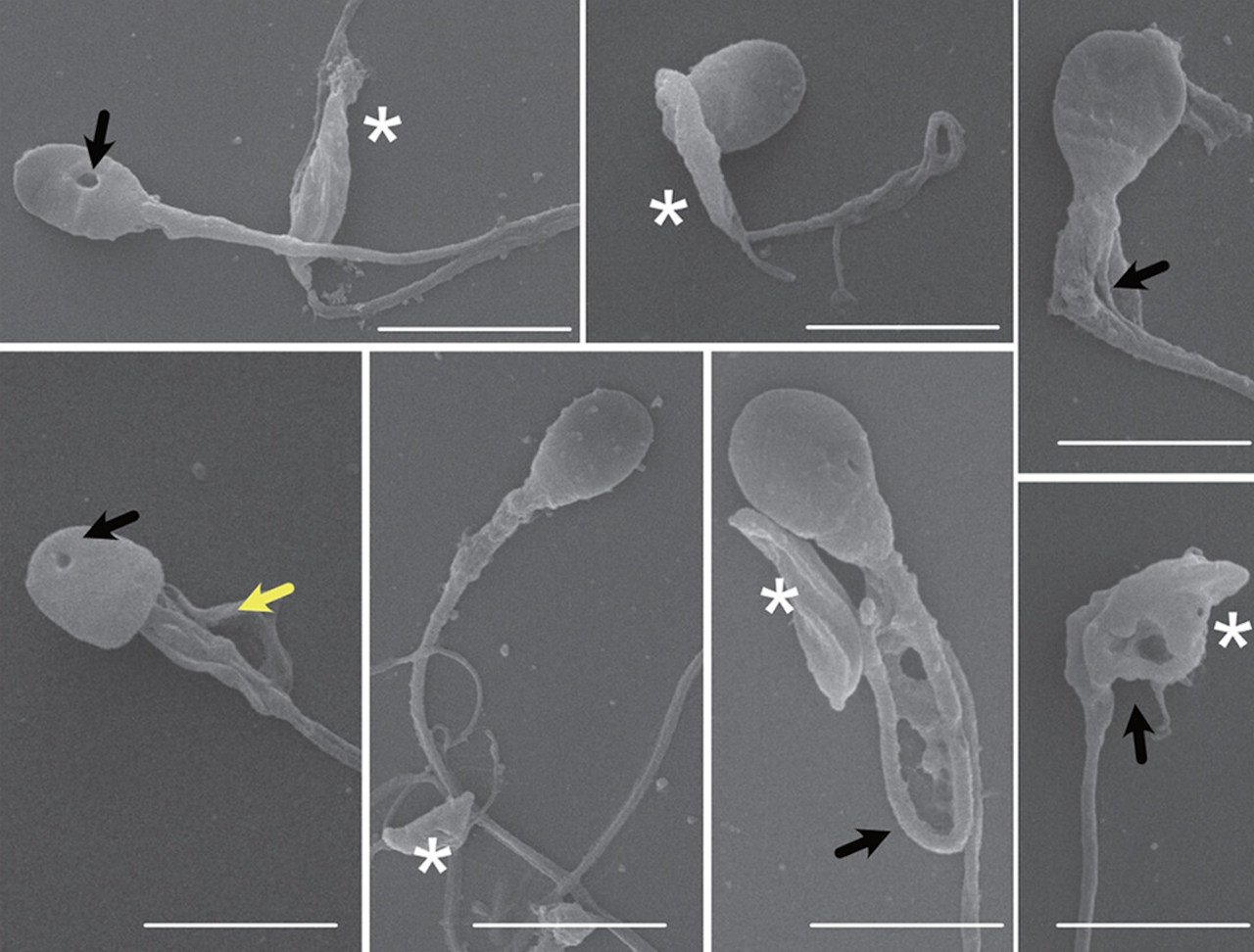 Rojas-Barón et al. / The FEBS Journal, 