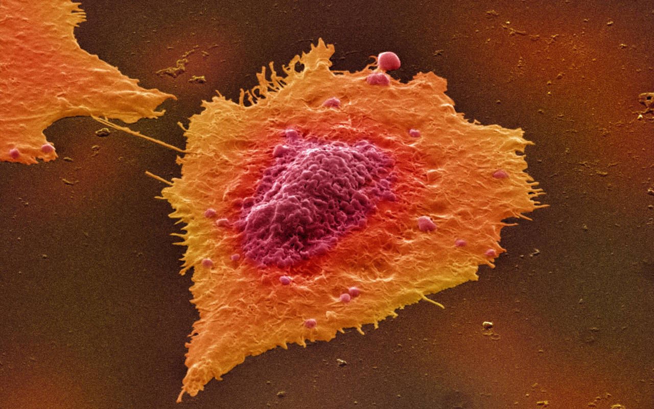 Клітини раку товстої кишки. UCL