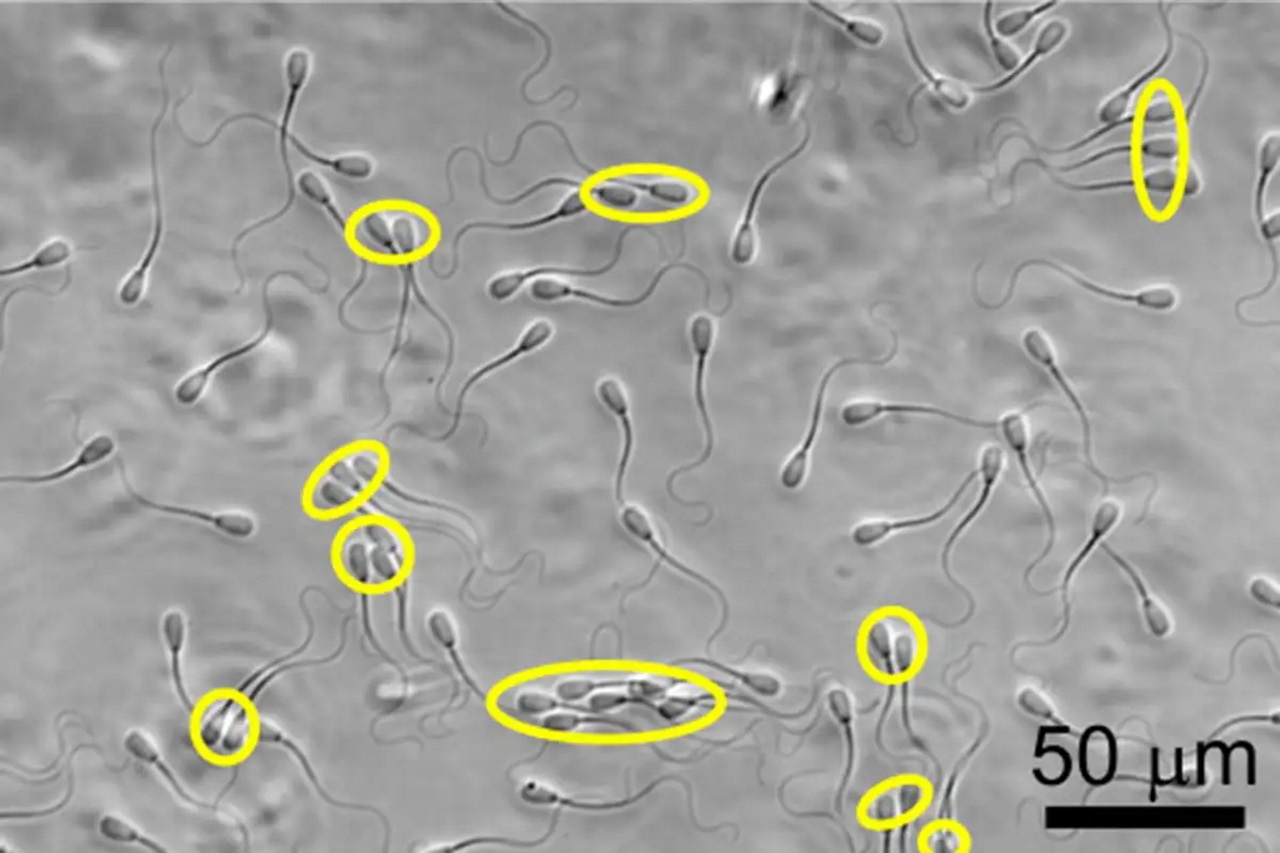 Сперматозоїди биків. Згуртовані виділені жовтим. Shiva Phuyal et al. /&amp;nbsp;Frontiers in Cell and Developmental Biology, 2022
