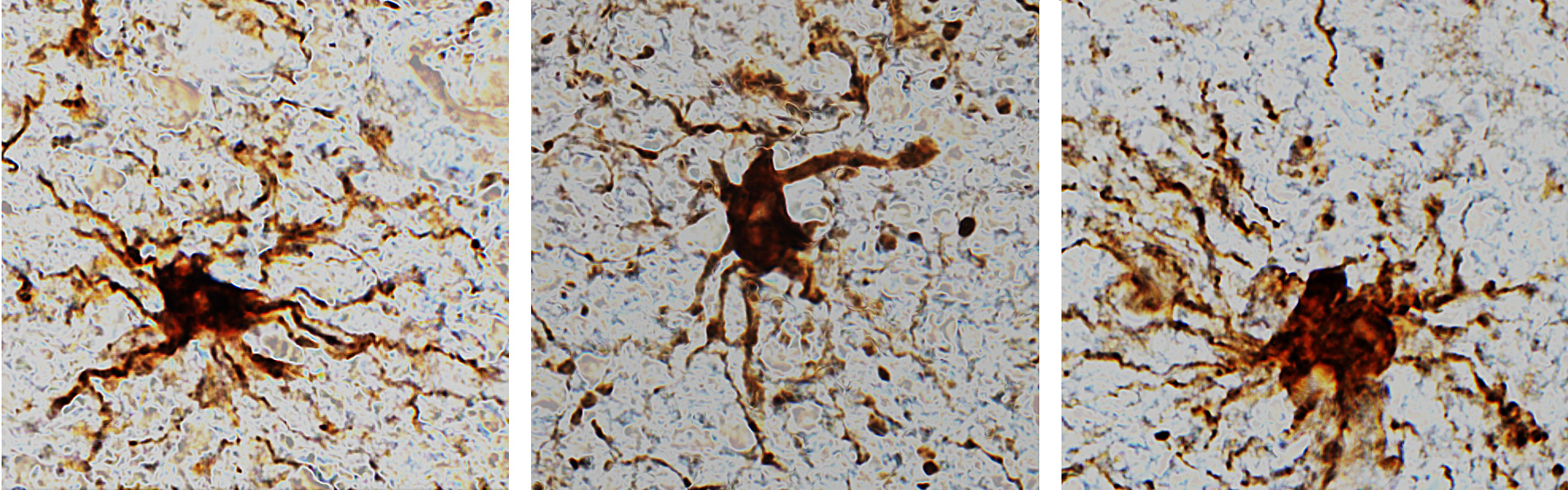 Гліальні клітини, що активізувалися після смерті мозку.  Dr. Jeffrey Loeb / UIC