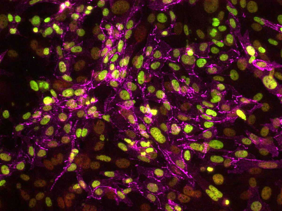 Клітини, яких перепрограмували в стовбурові. Клітини на проміжній стадії перетворення зафарбовані рожевим. UCLA Broad Stem Cell Research Center / Plath Lab