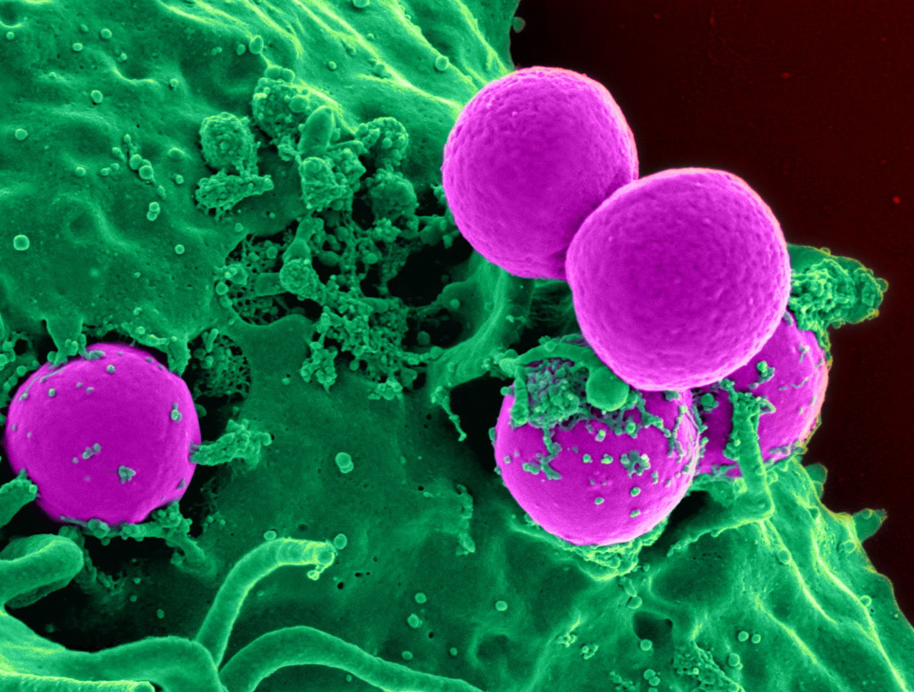 Метицилінрезистентні золотисті стафілококи (рожеві), яких поглинає нейтрофіл (зелений).&amp;nbsp;National Institutes of Health