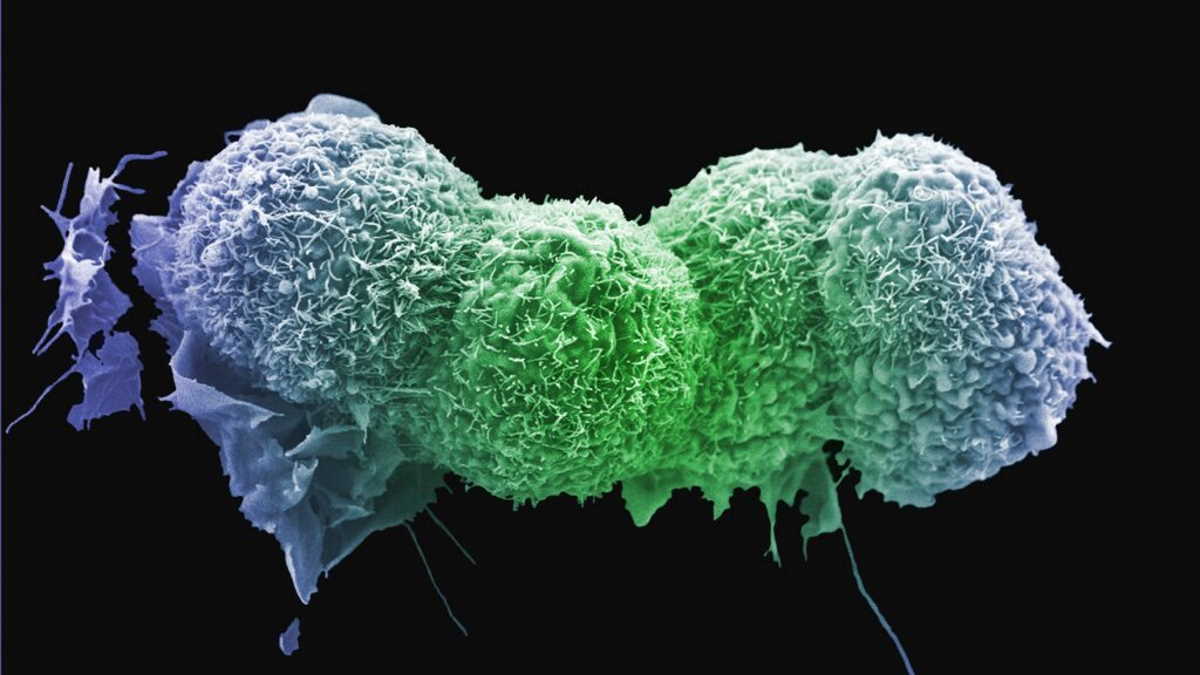 Клітина раку легень. Anne Weston / Francis Crick Institute