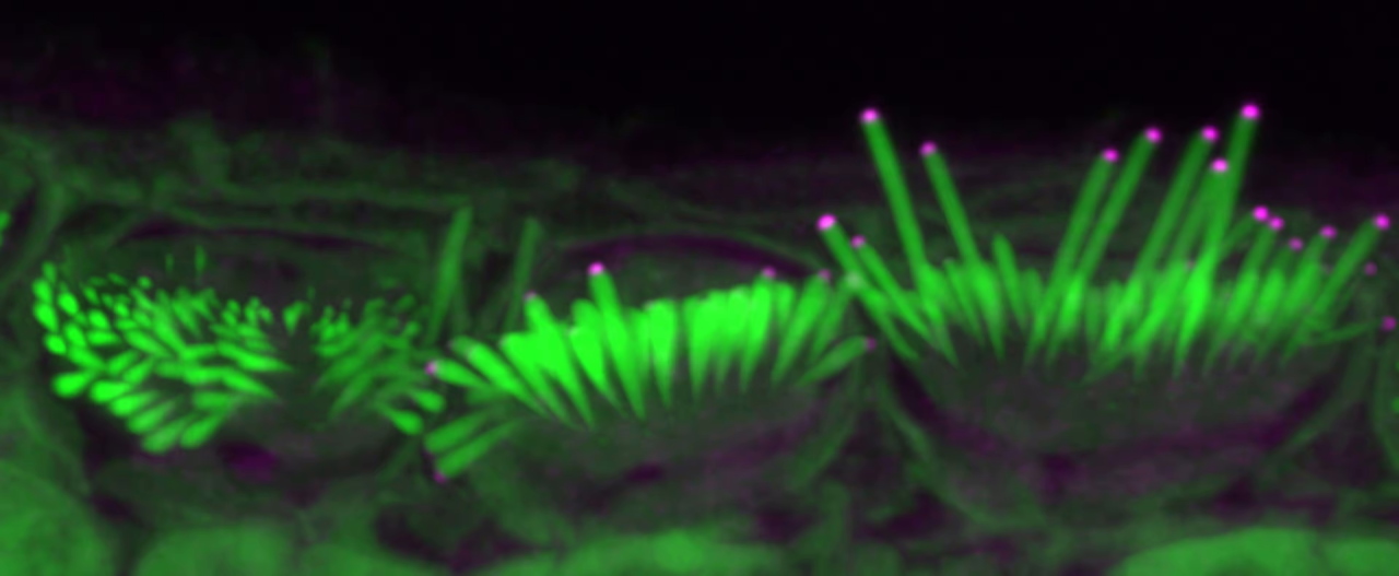 Мікроворсинки волоскових клітин при мутації в гені&amp;nbsp;Eps8 є закороткими (зліва). Але внаслідок збільшення кількості білка EPS8 (рожевий) після генної терапії вони подовжуються, забезпечуючи нормальну функцію чутливих клітин.&amp;nbsp;Salk Institute / Waitt Advanced Biophotonics Core