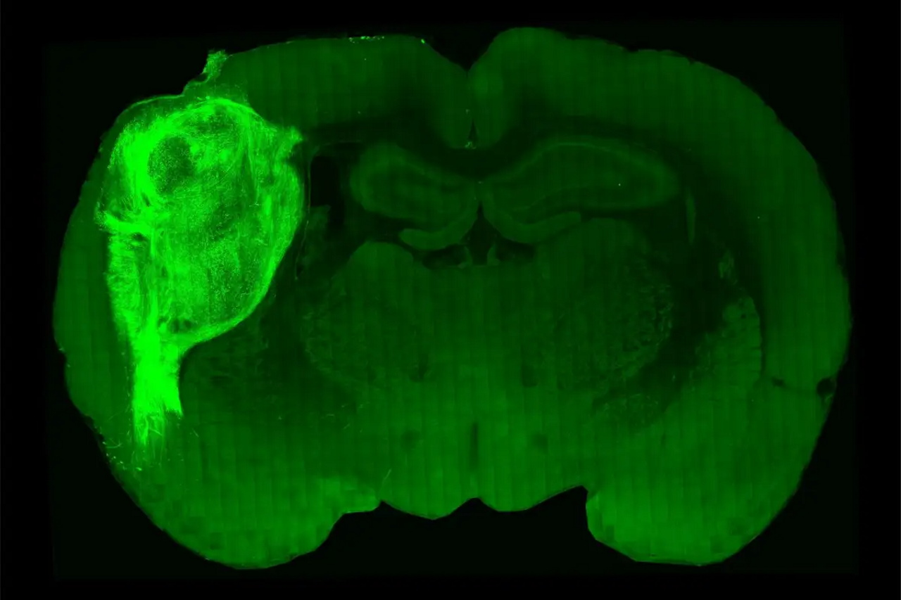 Пацючий мозок із інтегрованим у нього органоїдом людського мозку (підсвічений).&amp;nbsp;Stanford University