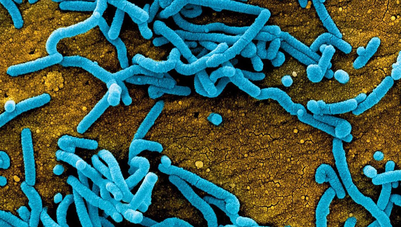 Частинки вірусу Марбург (сині) на поверхні інфікованої клітини (жовта).&amp;nbsp;National Institutes of Health