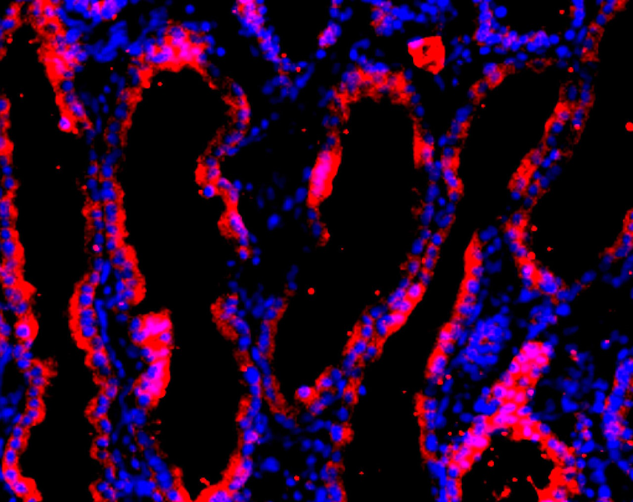 Тканина мезонефроса з ембріона свині із людськими клітинами (червоні).&amp;nbsp;Wang et al. / Cell Stem Cell, 2023