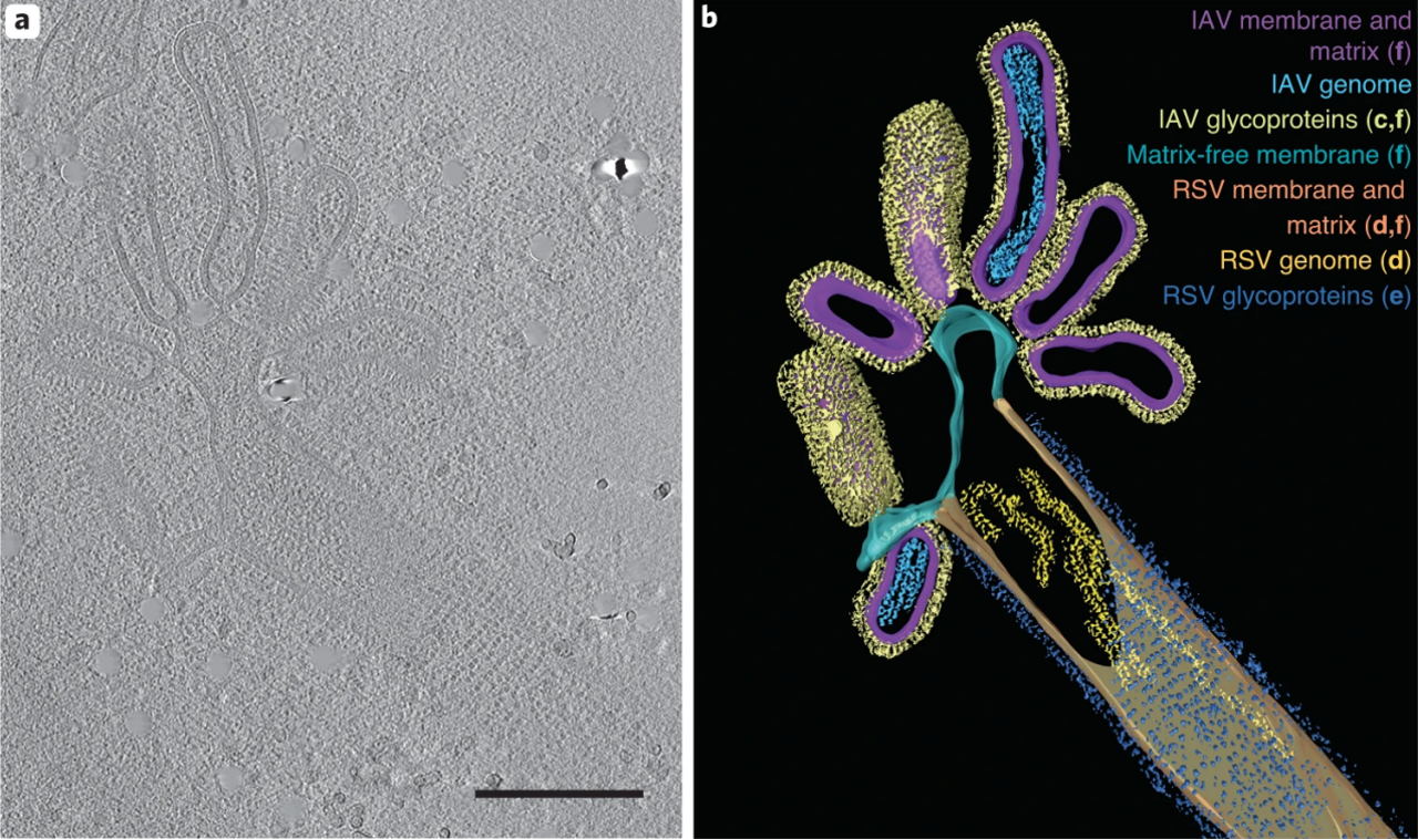 Вірусна частинка на зображеннях електронної кріотомографії. На ній представлені структури як вірусу грипу А (IAV), так і респіраторно-синцитіального вірусу (RSV).&amp;nbsp;Joanne Haney et al. / Nature Microbiology, 2022